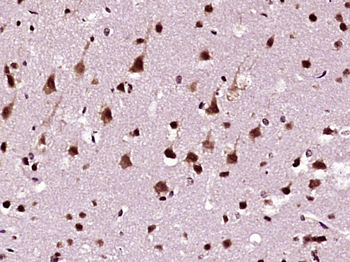 HnRNP DL Rabbit Polyclonal Antibody