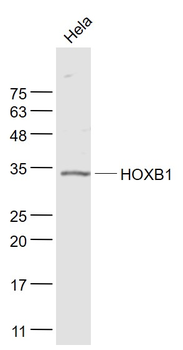 HOXB1 Rabbit Polyclonal Antibody