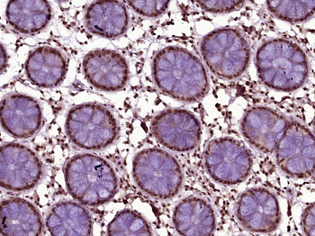 HOXD12 Rabbit Polyclonal Antibody