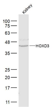 HOXD3 Rabbit Polyclonal Antibody
