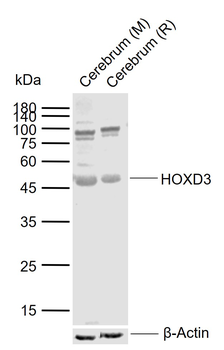 HOXD3 Rabbit Polyclonal Antibody