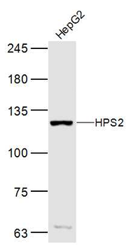 HPS2 Rabbit Polyclonal Antibody