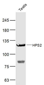 HPS2 Rabbit Polyclonal Antibody