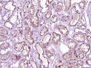 HRSP12 Rabbit Polyclonal Antibody