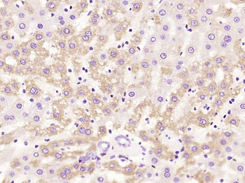 HSD17B11 Rabbit Polyclonal Antibody