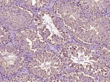 HSD17B13 Rabbit Polyclonal Antibody