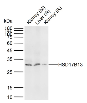 HSD17B13 Rabbit Polyclonal Antibody