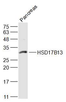HSD17B13 Rabbit Polyclonal Antibody