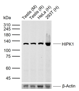 HIPK1 Rabbit Polyclonal Antibody