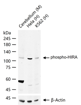 Phospho-HIRA (Thr555) Rabbit Polyclonal Antibody