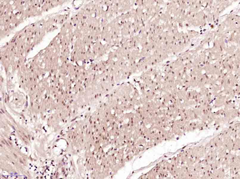 Histone H1.4 (tri methyl K25, phospho S26) Rabbit Polyclonal Antibody