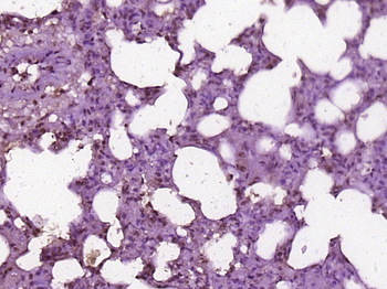 HMG2L1 Rabbit Polyclonal Antibody