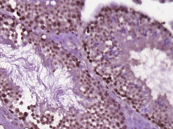 HMGN3 Rabbit Polyclonal Antibody