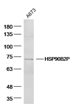 HSPA12A Rabbit Polyclonal Antibody