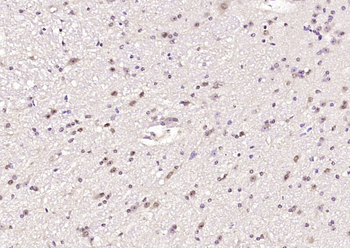 HSPA4L Rabbit Polyclonal Antibody