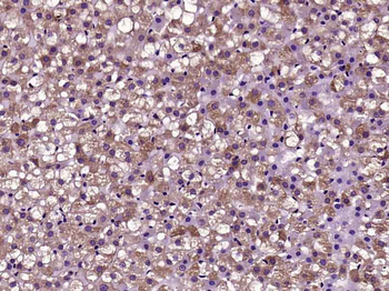 HUS1B Rabbit Polyclonal Antibody