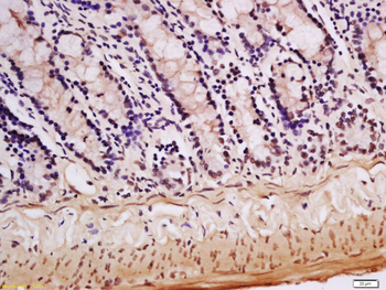 HnRNP M Rabbit Polyclonal Antibody