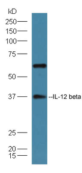 IL12B Rabbit Polyclonal Antibody