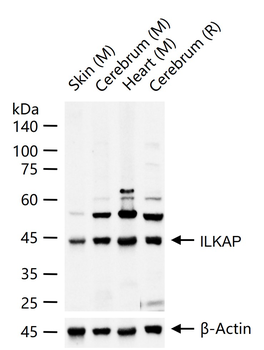 ILKAP Rabbit Polyclonal Antibody
