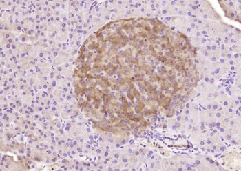 IMP3 Rabbit Polyclonal Antibody