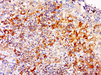 INO80 Rabbit Polyclonal Antibody