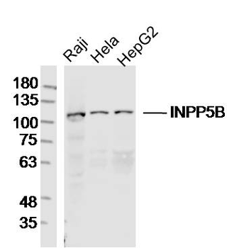 INPP5B Rabbit Polyclonal Antibody