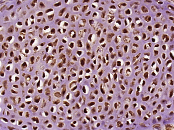 INT11/CPSF3L Rabbit Polyclonal Antibody