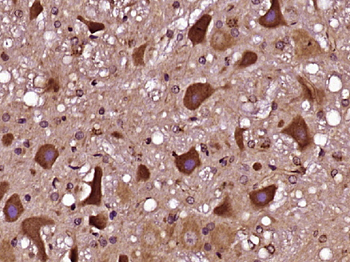 INT11/CPSF3L Rabbit Polyclonal Antibody