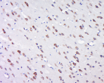 INT11/CPSF3L Rabbit Polyclonal Antibody