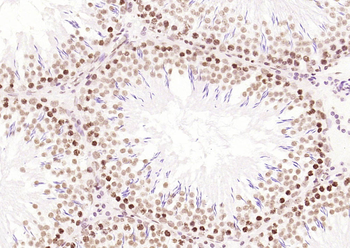 IRF2 Rabbit Polyclonal Antibody