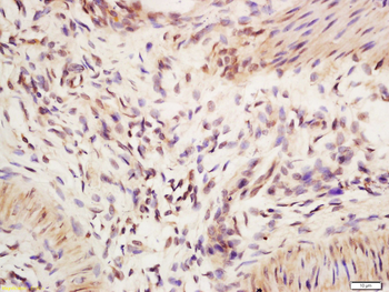 IRF2 Rabbit Polyclonal Antibody