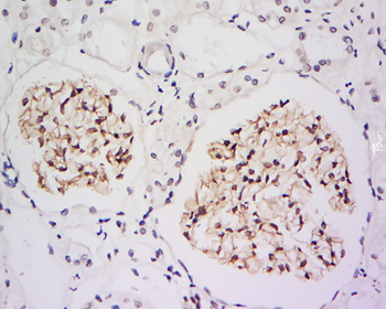 IRF2BP2 Rabbit Polyclonal Antibody