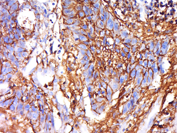 IRGQ Rabbit Polyclonal Antibody