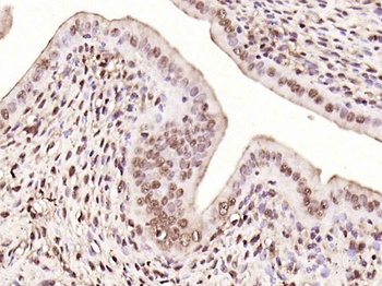 IRS1 (phospho-Ser616) antibody