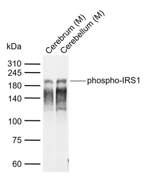 IRS1 (phospho-Ser616) antibody