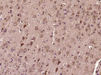 ITPKA Rabbit Polyclonal Antibody