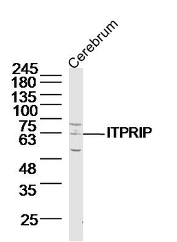 ITPRIP Rabbit Polyclonal Antibody