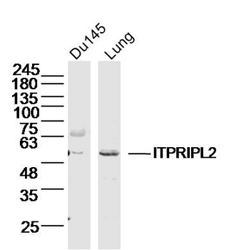 ITPRIPL2 Rabbit Polyclonal Antibody