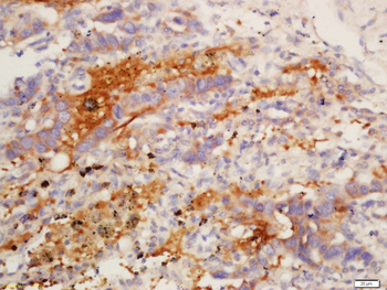 IL12B Rabbit Polyclonal Antibody