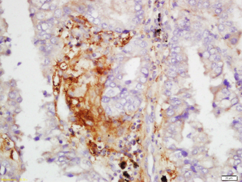IL12B Rabbit Polyclonal Antibody