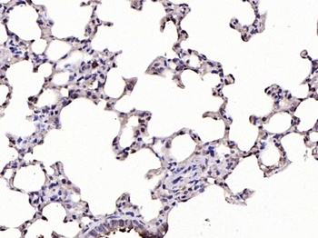 IKB alpha (phospho-Ser32) antibody