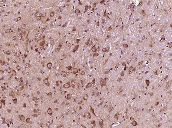 Phospho-IKB alpha (Ser36) Rabbit Polyclonal Antibody