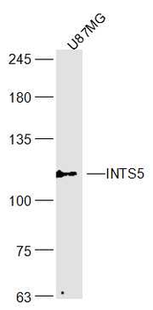 INTS5 Rabbit Polyclonal Antibody