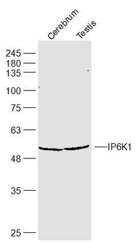 IP6K1 Rabbit Polyclonal Antibody