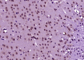 JNK1+JNK2 Rabbit Polyclonal Antibody