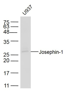 Josephin-1 Rabbit Polyclonal Antibody