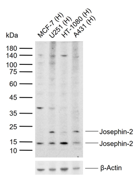 Josephin-2 Rabbit Polyclonal Antibody
