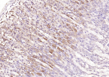 JTB Rabbit Polyclonal Antibody