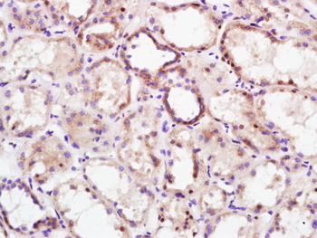 KEAP1 Rabbit Polyclonal Antibody