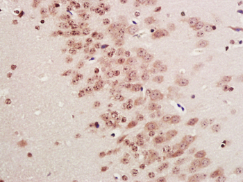 KEAP1 Rabbit Polyclonal Antibody